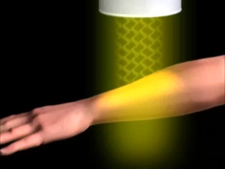 Video Poster - Światło BIOPTRON<sup>®</sup> - Jak to działa